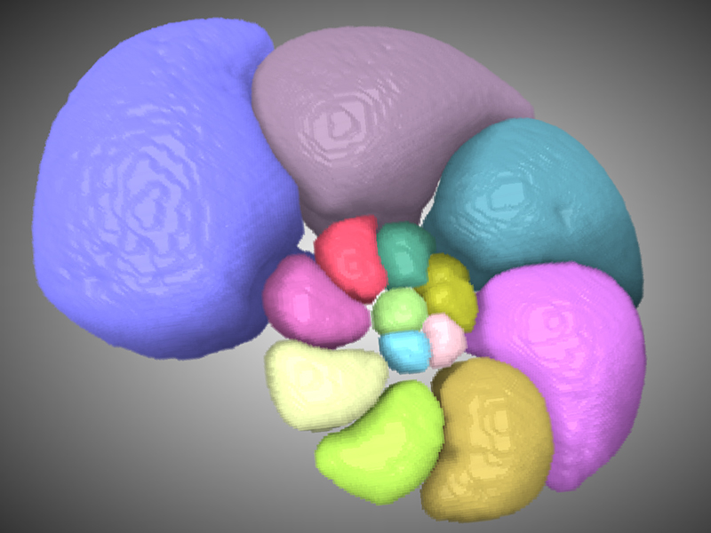 Chambers of a C. wuellerstorfi var. lobotulus