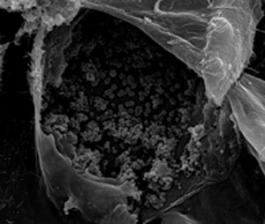 SEM image of a Hela cell infected with C. trachomatis