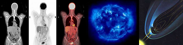 The effects of ionizing radiation on people are of interest in many research and industrial areas, including medicine, air travel, and space exploration.