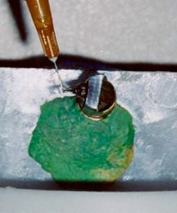 Application of the US with a syringe. Application of the US with a syringe.