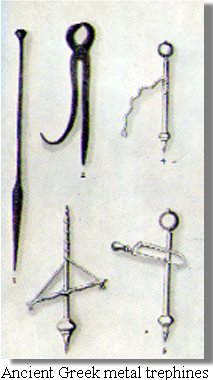Ancient Greek Metal Trephines