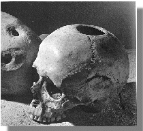 Skull with hole on top of head