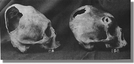 2 Skulls with holes in back of head
